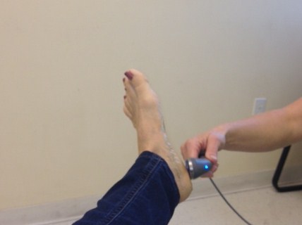 Shot in foot on sale for plantar fasciitis