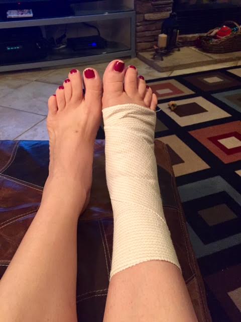 Swelling up...and I wished I hadn't put off that pedicure since I was headed to the foot doc! 
